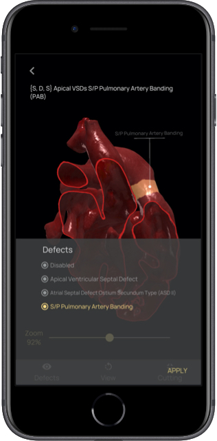 App mobile per taglio digitale del cuore 3D App mobile per taglio digitale del cuore 3D
