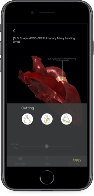 App con evidenziazione difetti del cuore 3D App con evidenziazione difetti del cuore 3D