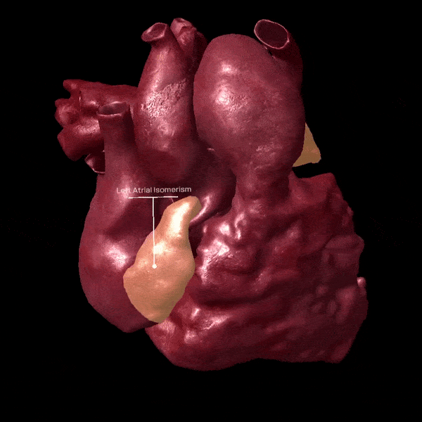 Evidenziazione difetti del cuore in real time Evidenziazione difetti del cuore in real time